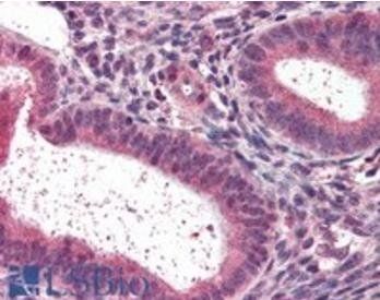 LXR beta/NR1H2 Antibody