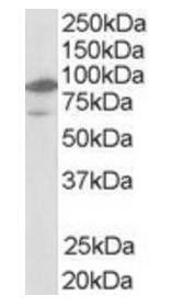 LXR beta/NR1H2 Antibody
