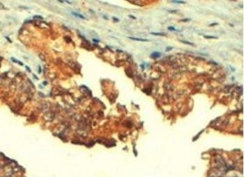 ABCC4/MRP4 Antibody