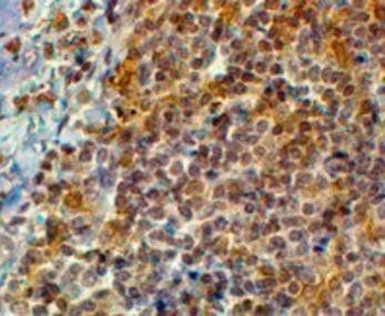 Swiprosin 1/EFHD2 Antibody