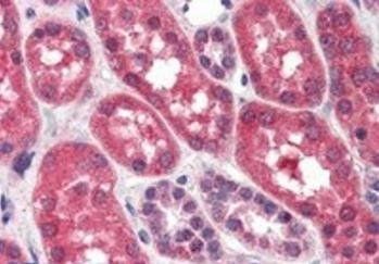 FGFR1 Antibody