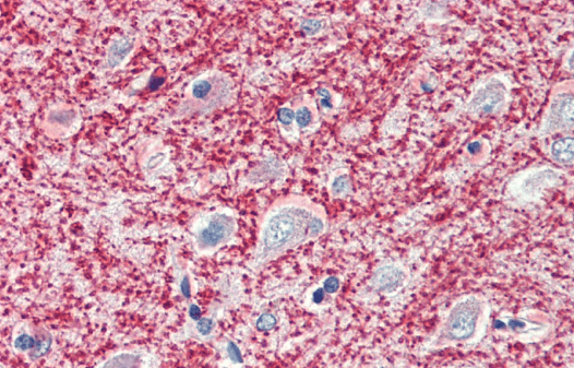 Goat anti-PCSK9 (C Terminus) Antibody