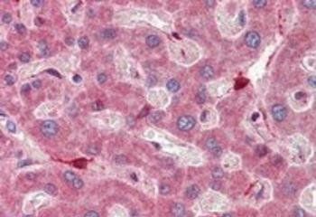 RBP1 Antibody