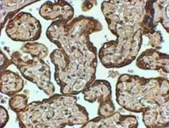 PAI1/SERPINE1 Antibody