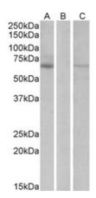 Makorin Antibody