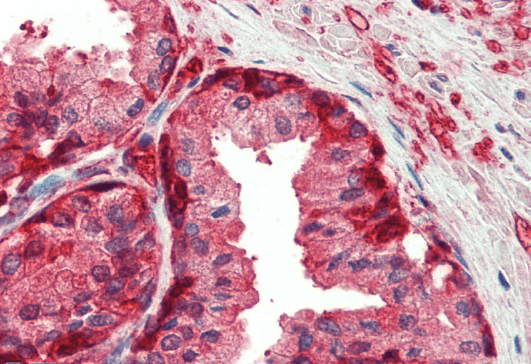 GST3/GSTP1 Antibody