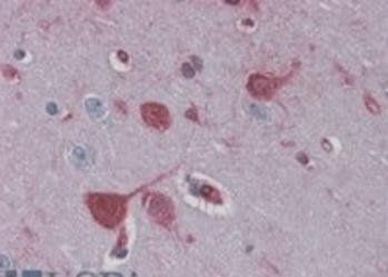RAE1 Antibody