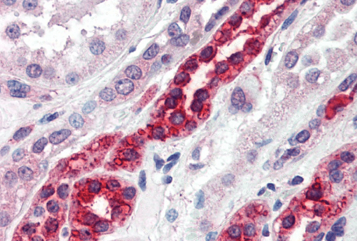 GGA3 Antibody