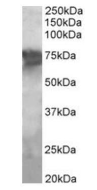PCK2/PEPCK-M Antibody