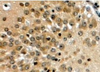 NOTCH3 Antibody