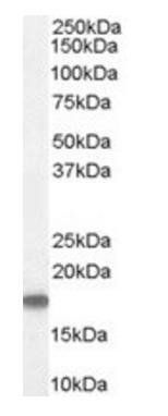 STMN1/Stathmin 1 Antibody
