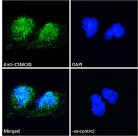 Casein Kinase 1, delta Antibody
