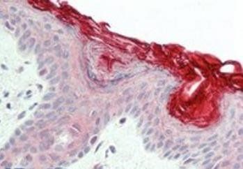 PERP Antibody
