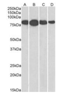 Radixin Antibody