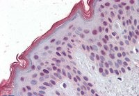 MBD2 (isoform 1) Antibody