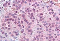 MBD2 (isoform 1) Antibody
