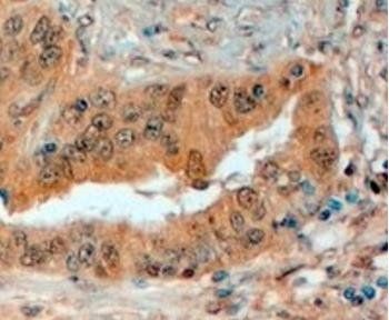 Semaphorin 3E (internal) Antibody