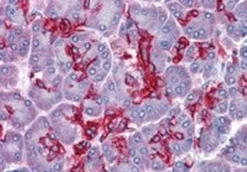 CGI58/ABHD5 Antibody