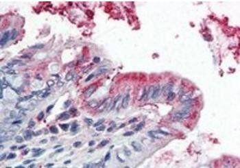 GPX3 Antibody
