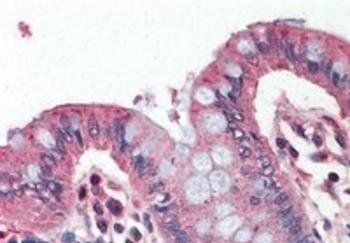 Perilipin 1 (C Terminus) Antibody