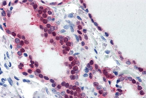 TIA1 Antibody