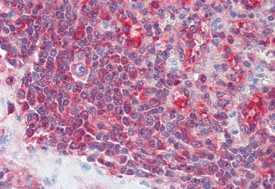 PSME2 Antibody