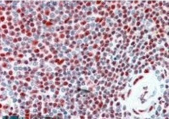 ILF2/NF45 Antibody