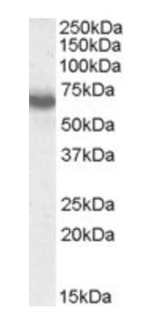 IKZF1/IKAROS Antibody