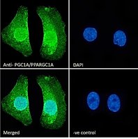 PGC1A/PPARGC1A Antibody