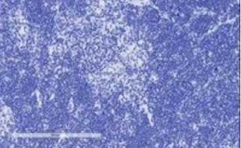 Tcfec (mouse) Antibody