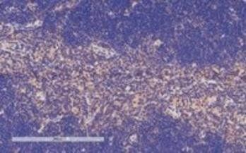 Tcfec (mouse) Antibody