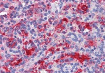 DDX58 Antibody