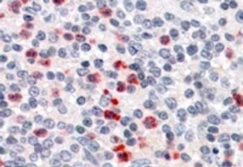 PGRP-S Antibody