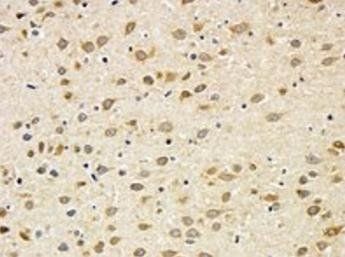BDNF Antibody