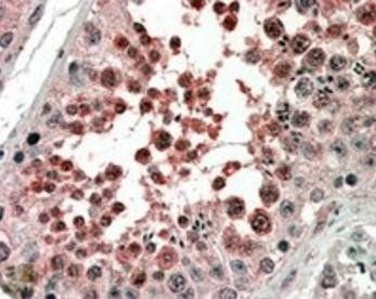 ACVR1 Antibody