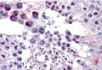 FZD9 Antibody
