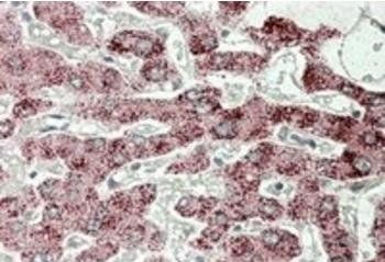Sterol carrier protein 2 Antibody