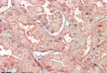 SFRP1 Antibody
