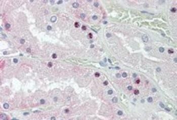 HOXD10 Antibody