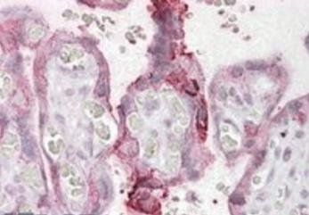 NCE2/UBE2F Antibody
