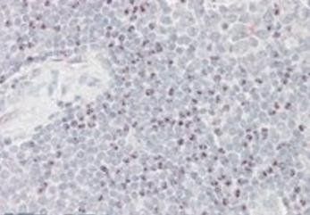 BAT3/BAG6 Antibody