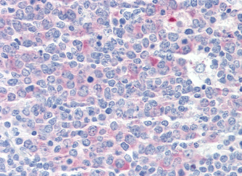 CCT3/TCP1 Antibody
