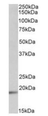 UBE2C/UBCH10 Antibody
