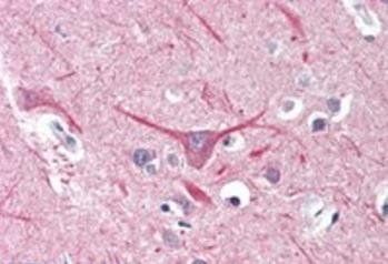 UBR2 Antibody