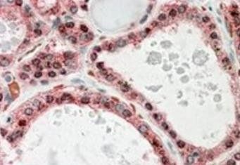 KCNN2 Antibody