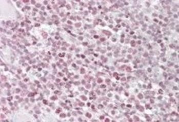 IKAROS/IKZF1 Antibody