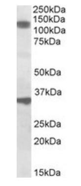 CCAR1 Antibody
