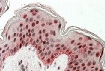 TIAL1 & TIA Antibody