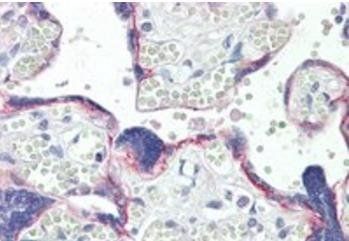 BOD1 Antibody