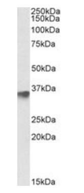 FBXO4 Antibody